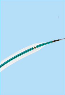 Pantera™ Pro Coronary Dilatation Catheter